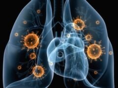 5-super-foods-you-must-have-during-pneumonia-for-a-speedy-recovery